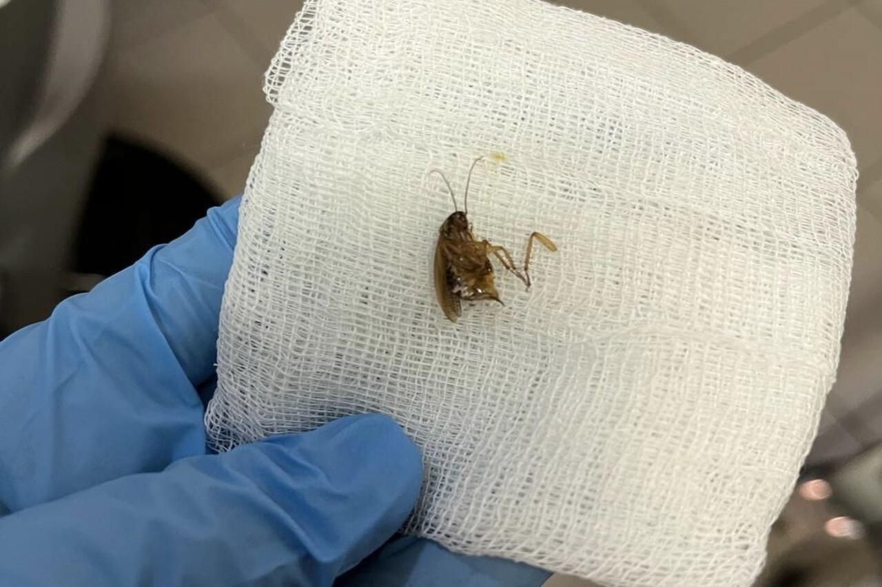 Врачи Видновской больницы достали из уха женщины живого таракана